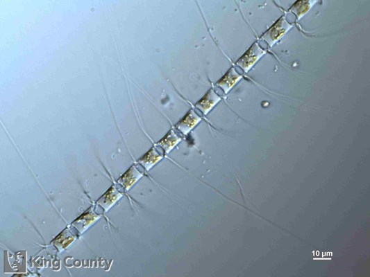 Photo of Chaetoceros crucifer